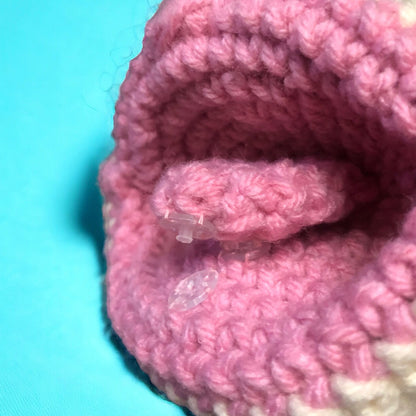 Modelo tejido de boca, con labios y lengua con anquiloglosia tipo 1 y 2